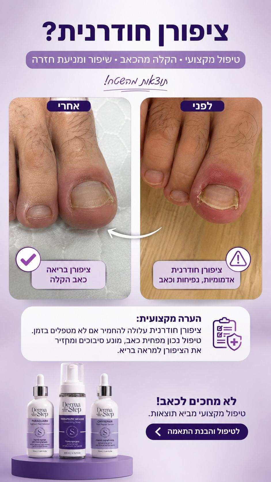 ערכה לטיפול בציפורן חודרנית