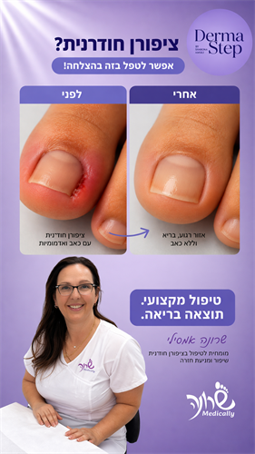 סרום לשיקום וטיפול בציפורניים פגועות