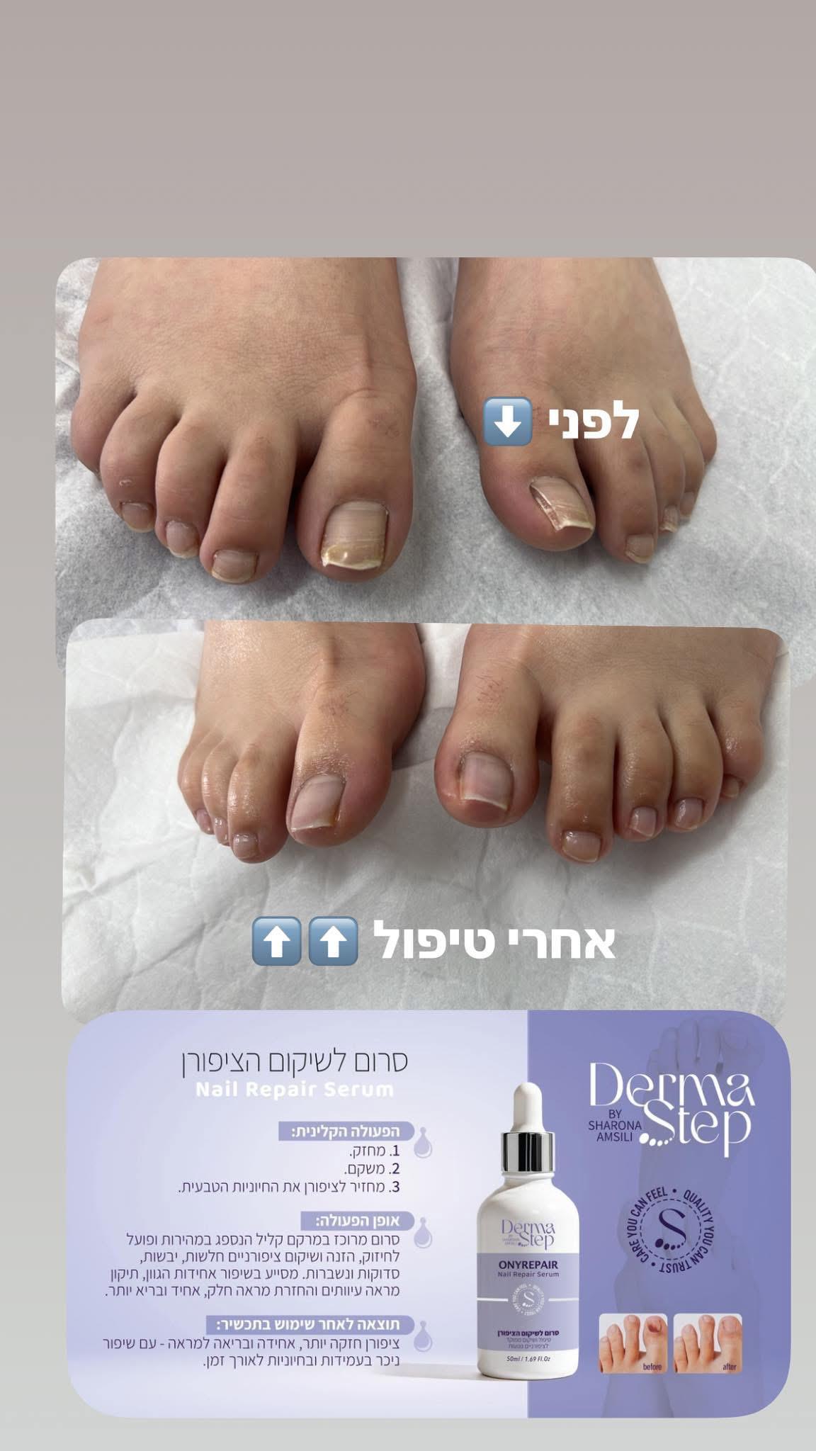 סרום לשיקום וטיפול בציפורניים פגועות