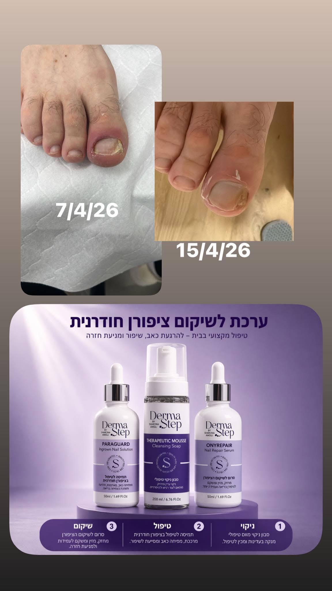 סרום לשיקום וטיפול בציפורניים פגועות