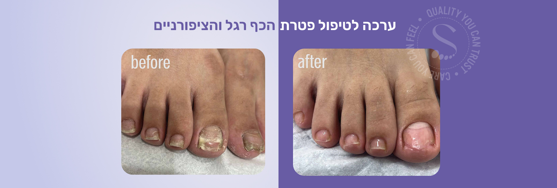 תמונה ללא תיאור