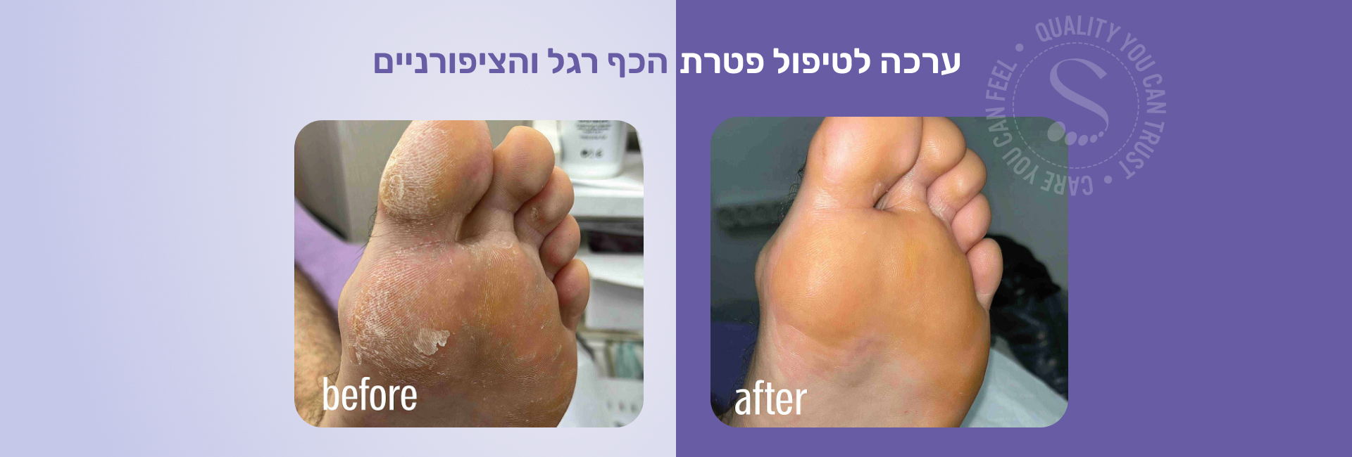 תמונה ללא תיאור