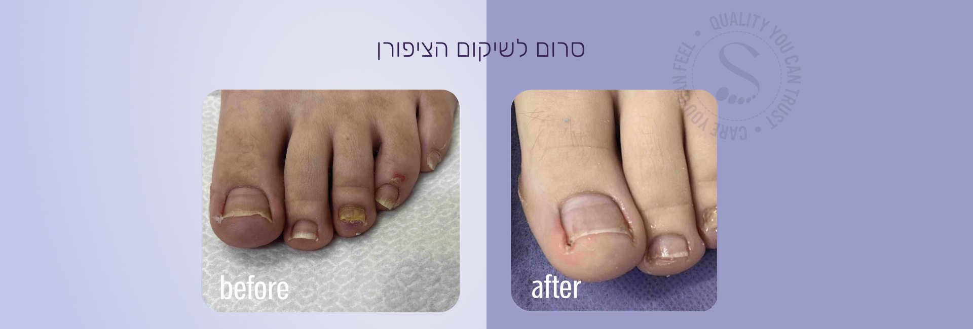 תמונה ללא תיאור